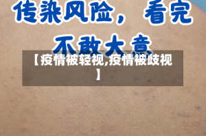 【疫情被轻视,疫情被歧视】