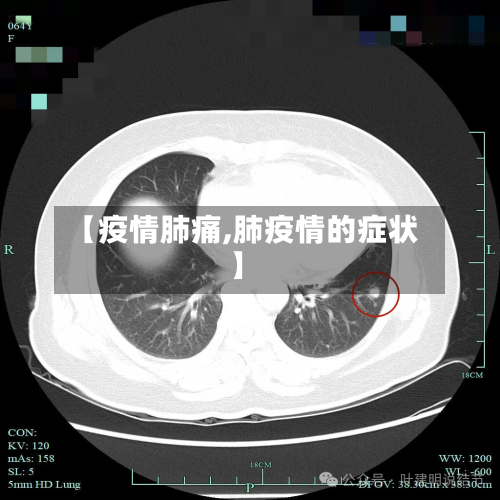 【疫情肺痛,肺疫情的症状】-第1张图片