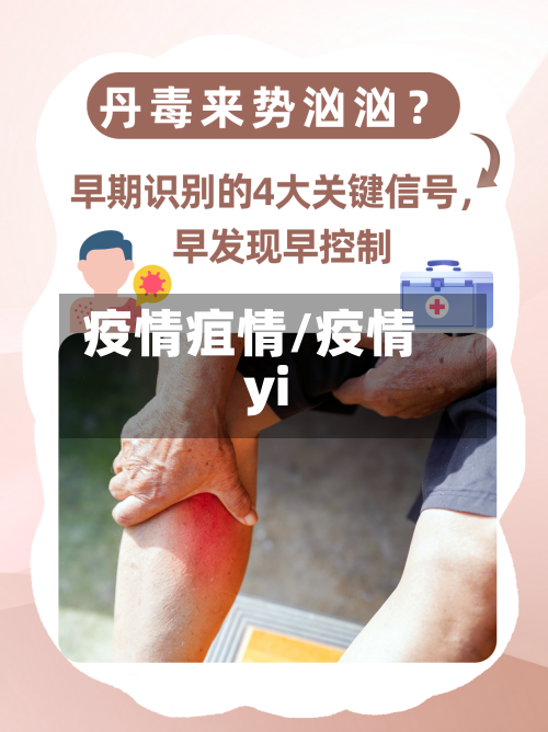 疫情疽情/疫情yi-第2张图片
