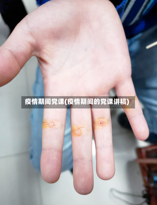 疫情期间党课(疫情期间的党课讲稿)-第2张图片